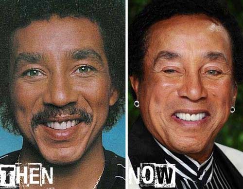 Silly Result of Smokey Robinson Plastic Surgery